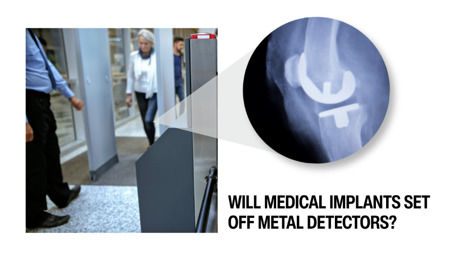 Will Medical Implants Set Off Metal Detectors?